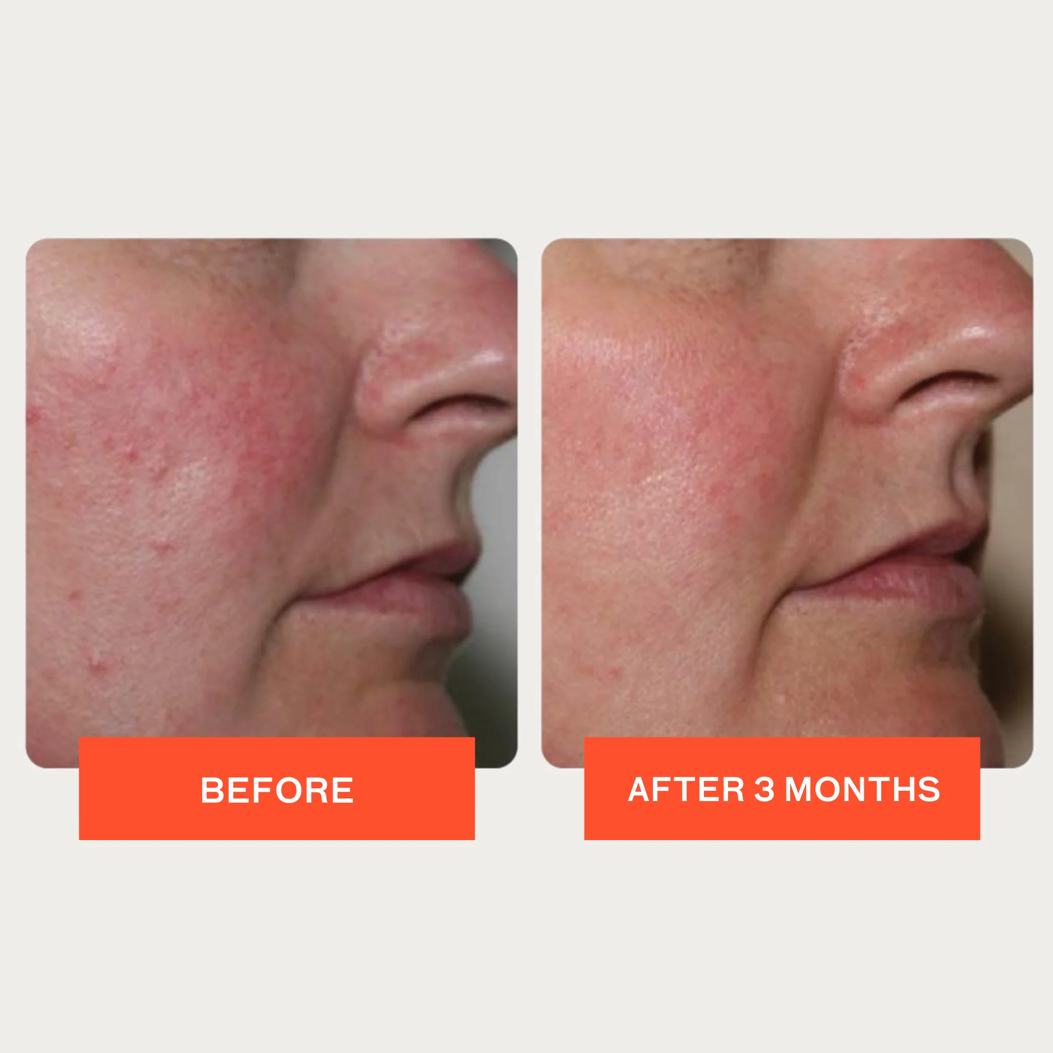 Pro-Heal Serum Advance+ - Image 3